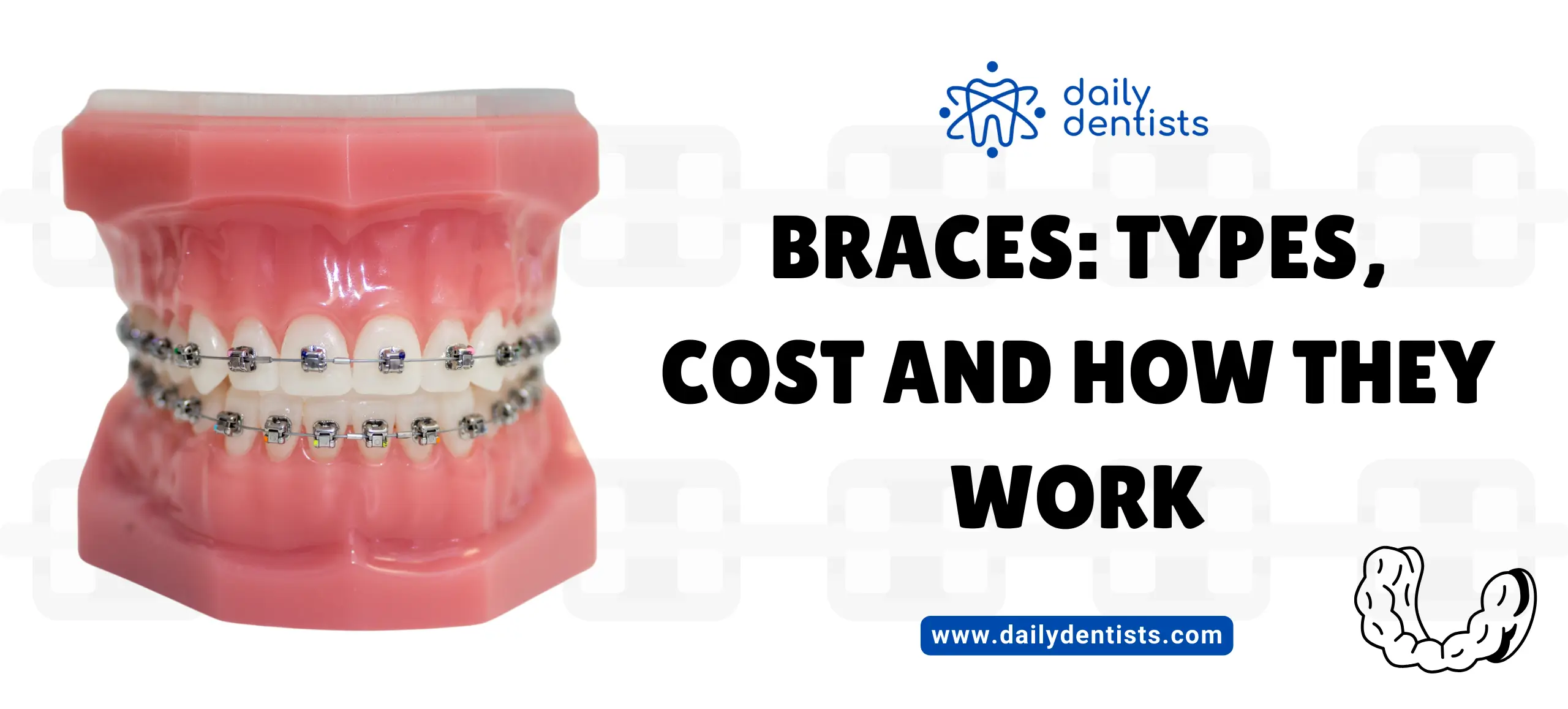 Braces: Types, Cost and How They Work