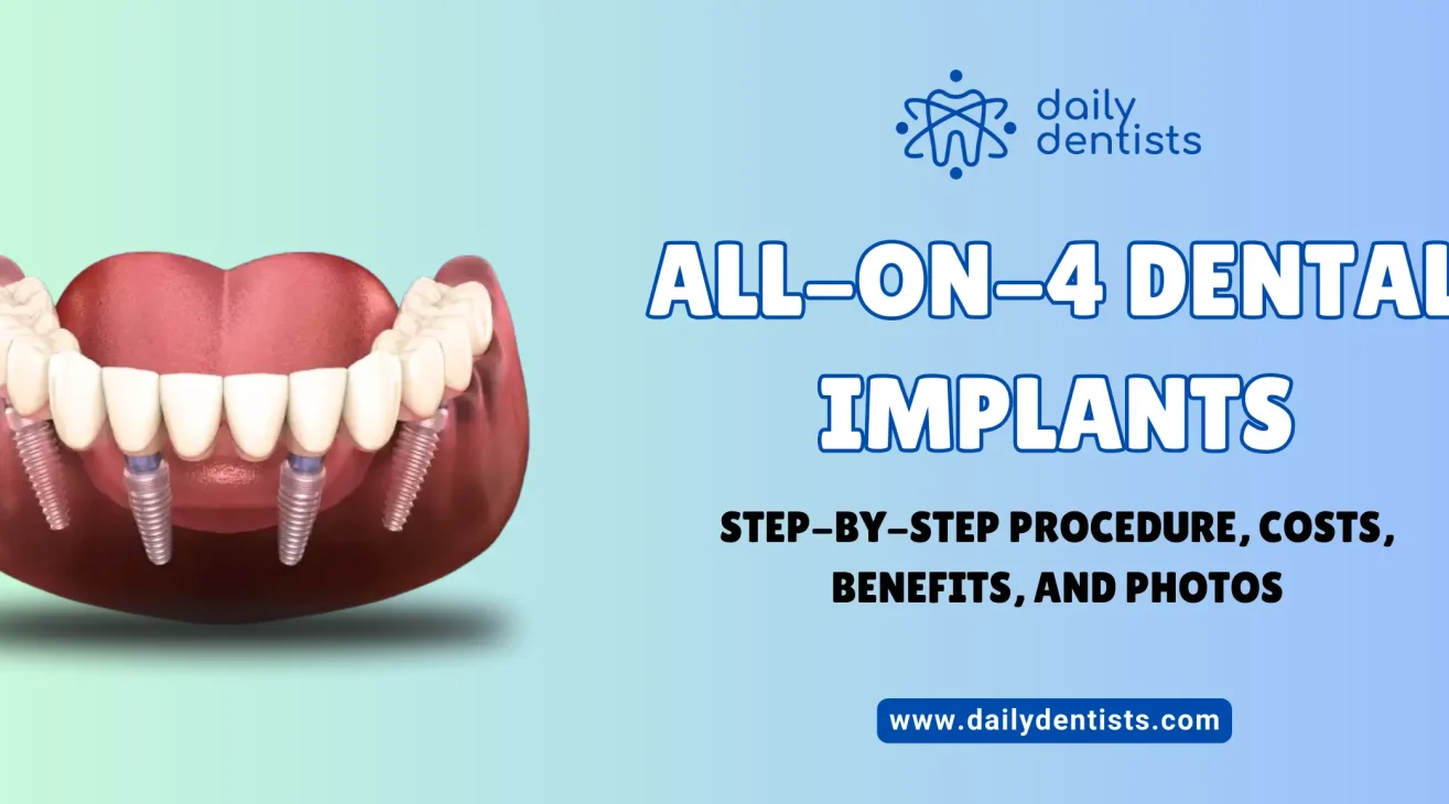 All-On-4 Dental Implants: Step-by-Step Procedure, Costs, Benefits, Photos, and Video