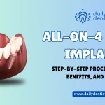 All-On-4 Dental Implants: Step-by-Step Procedure, Costs, Benefits, and Photos