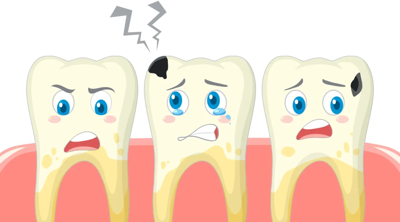 How to Fix Tooth Discoloration After a Root Canal