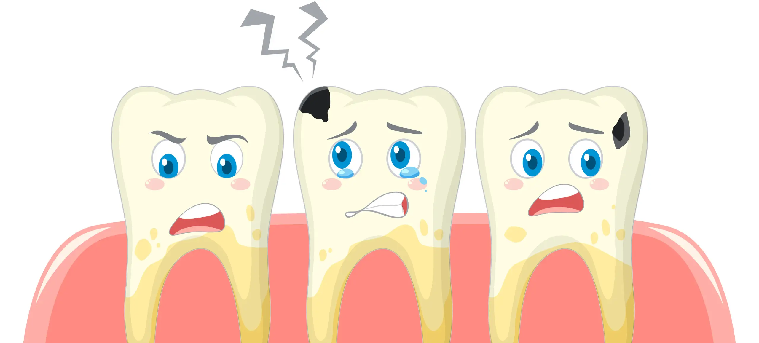 How to Fix Tooth Discoloration After a Root Canal