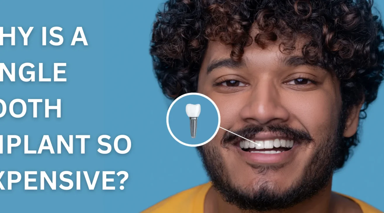 Why Is a Single Tooth Implant So Expensive?
