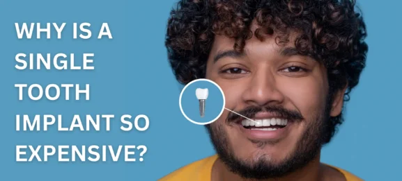 Why Is a Single Tooth Implant So Expensive?